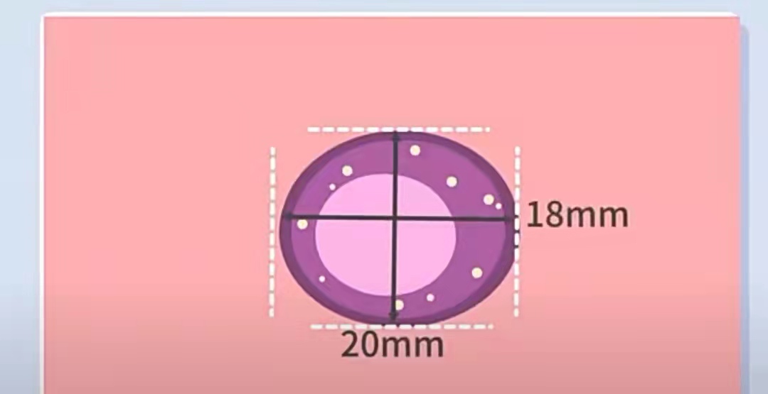 吃什么能生下聪明宝宝,吃什么能养卵子的质量