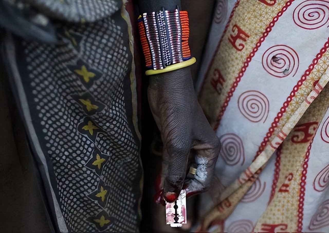 被切掉重要器官的女人是什么,被切掉生殖器官的真实案件