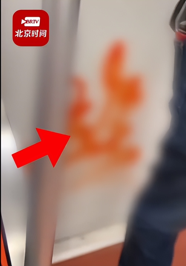 甲流和新冠症状上有哪些区别图片,甲流和新冠症状的区别