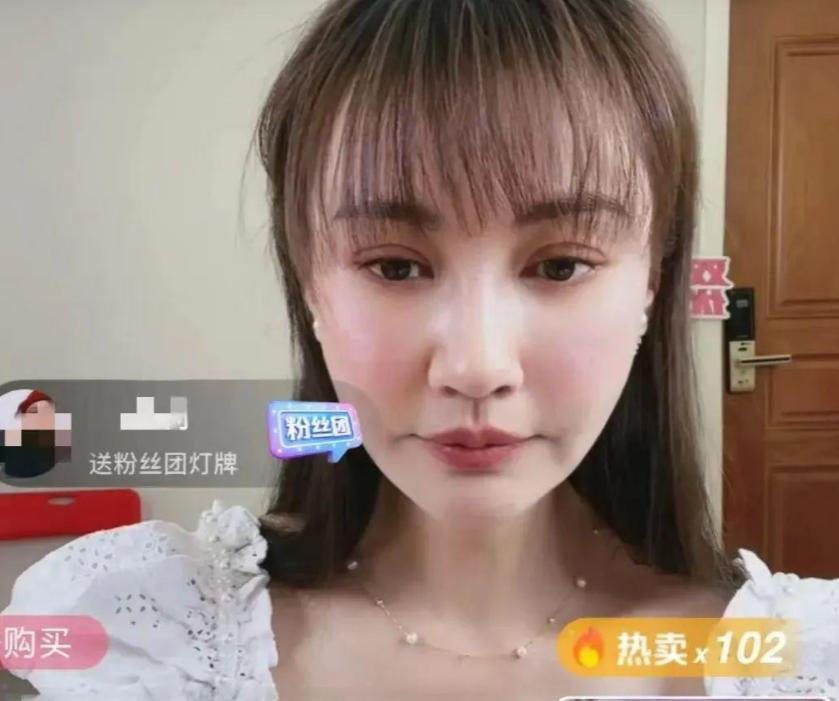 整容整毁的女明星对比照,整容失败女明星今昔对比