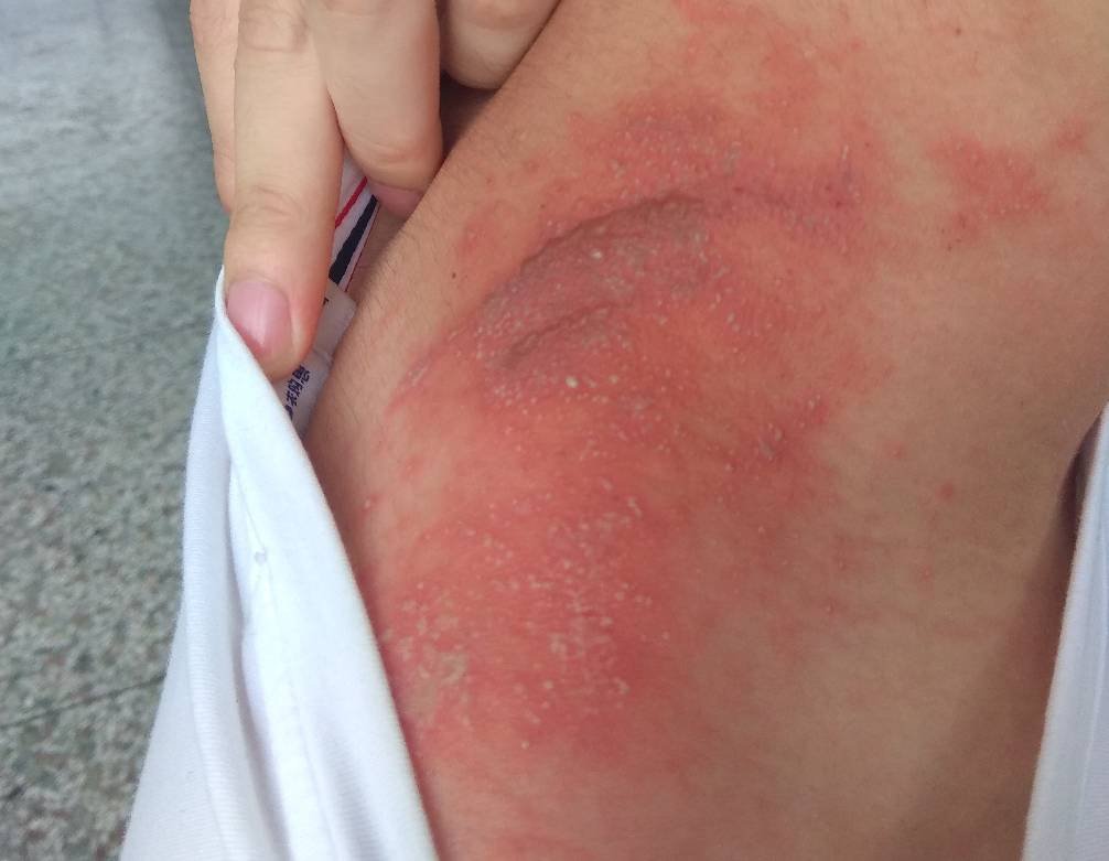 五毒之一的蜈蚣为什么害怕公鸡,蜈蚣怕公鸡公鸡怕什么