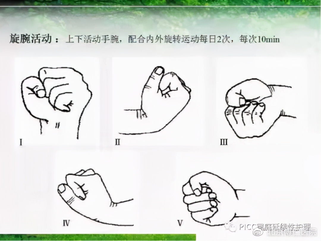 不扎肉肉、不咋疼、方便又实惠的“输液通道”,究竟是何方神圣?