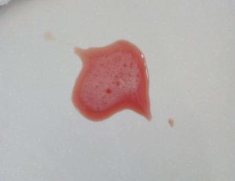 猫咪呕吐铲屎官的反应,猫咪总想呕吐但是吐不出来怎么办