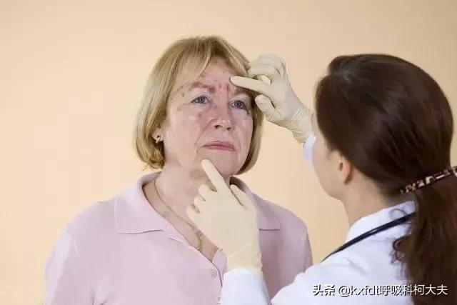 肺癌一定会有什么表现,肺癌可引起哪些并发症