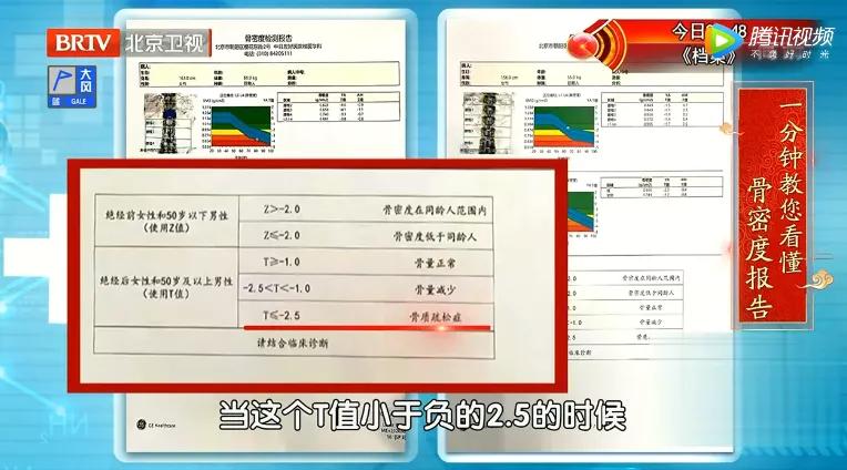 骨质疏松吃什么钙最能吸收,骨质疏松吃哪种钙补得快