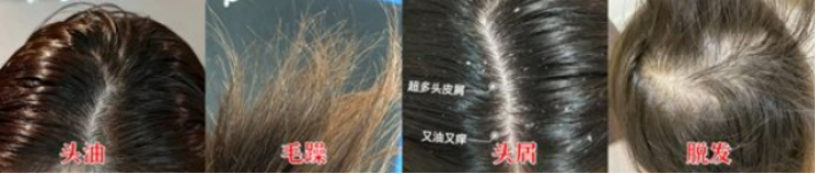 孕妇油头细软塌洗发水推荐,孕妈妈头发油用什么洗发水