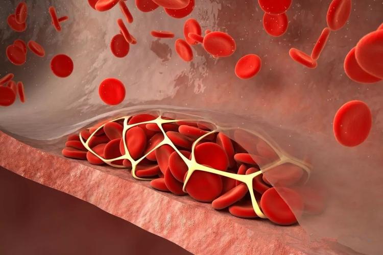 哈欠不断千万别大意！如果出现这些症状，赶紧查！可能会致命！