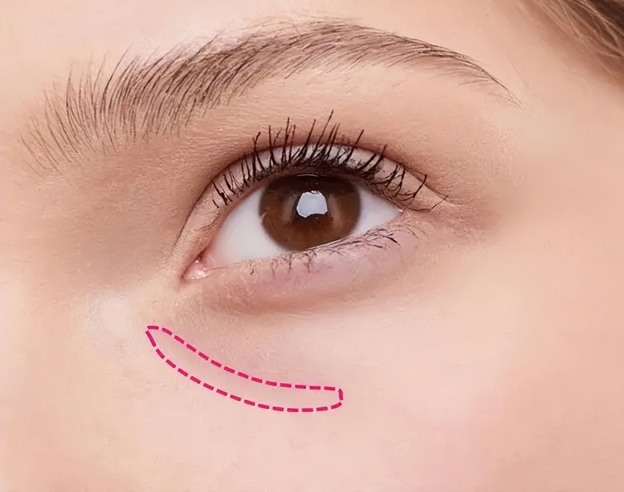 连女明星都喜爱的轮廓固定，究竟有何魅力？