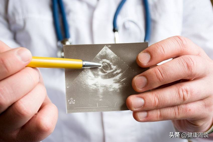 孕期需要采用阴式B超筛查？它是否伤身？医生：这3类孕妇，建议做