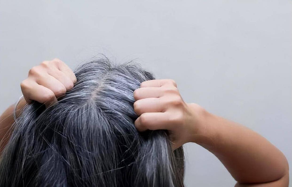 白发长在前面两侧后脑勺代表什么,白发长在正头顶代表身体哪个器官