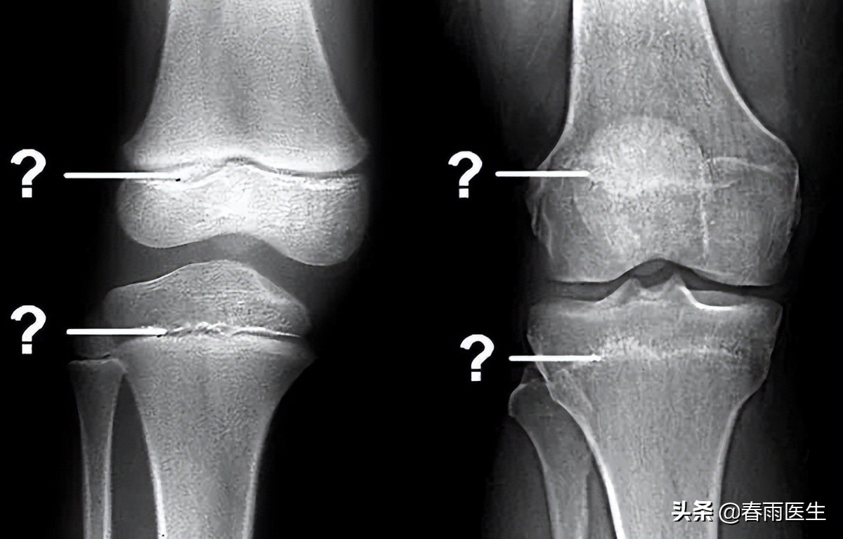 快来对照一下孩子的身高达标了吗,对照一下你家孩子身高达标了吗