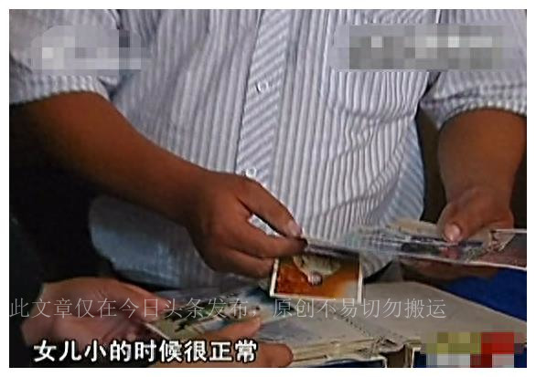 真实故事女子患怪病,真实事件女孩长胡子