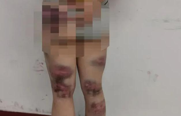 2019年，江苏一饭店女老板抄铁棍暴打闺女被刑拘：她30岁还没嫁人