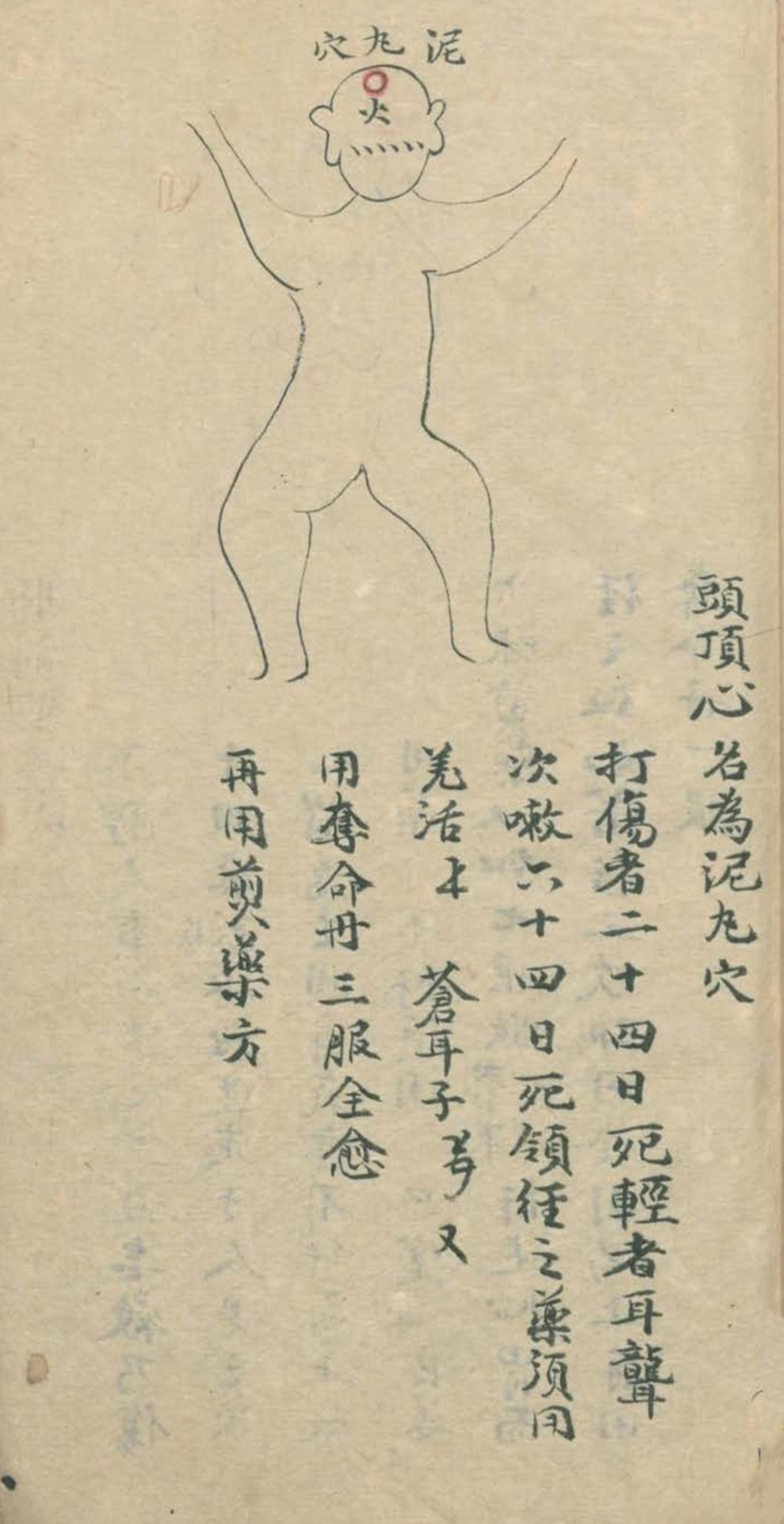 最实用的跌打药方,祖传跌打秘方100首