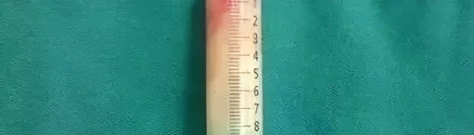 怀孕吃小龙虾辣到早产,孕35周吃了火锅后一直宫缩