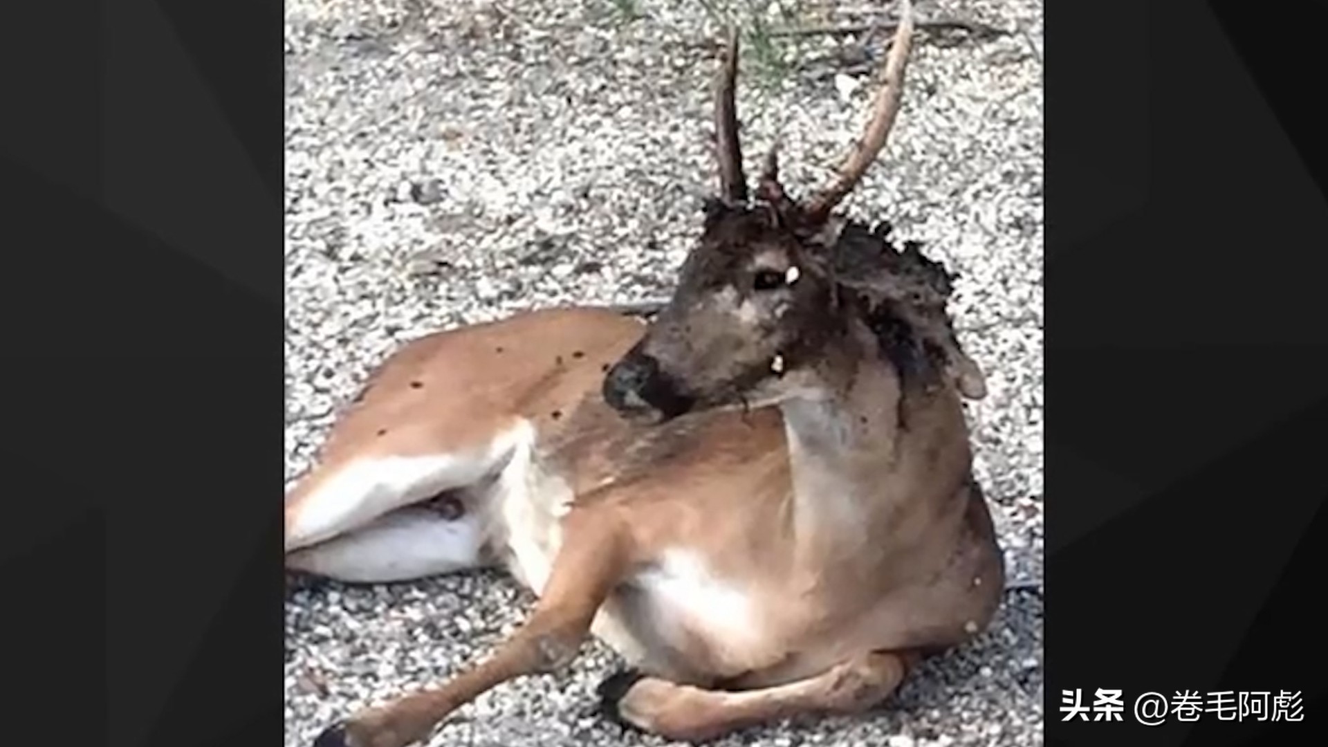 美国女子吃蜱虫被咬死,美国女子被虫子咬