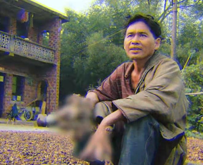 男子得了怪病身上长了树枝,男子患怪病手脚长得像树枝