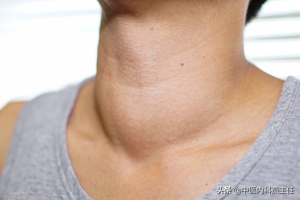 甲状腺囊实性结节3类会自愈吗,甲状腺结节自愈的最佳方法小妙招