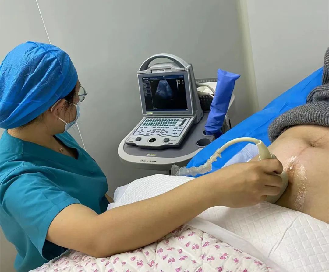 又一瘢痕子宫妈妈成功顺产……