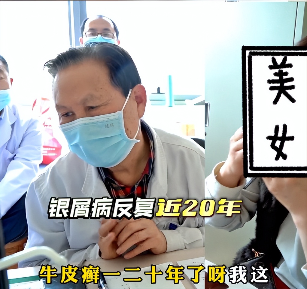 女性银屑病的治疗方法,银屑病中医临床治疗案例