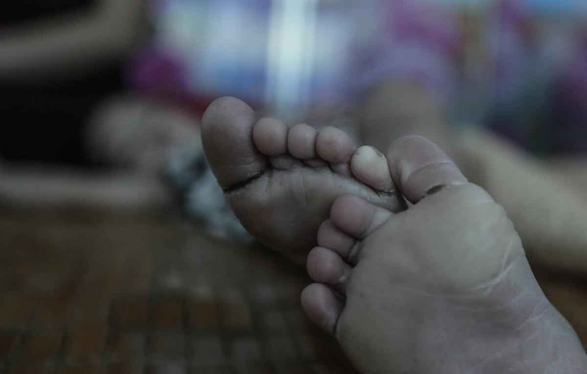 12年湖北双胞胎十指咬秃流血，却不会哭，父母拿到诊断书如遭雷击