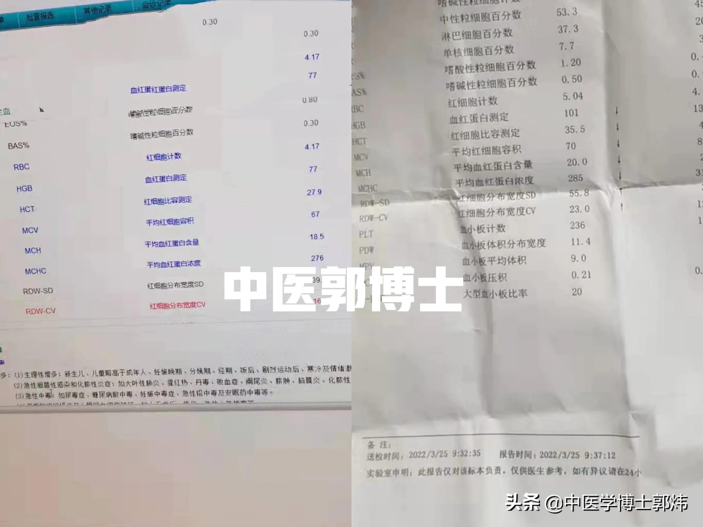 血虚头晕喝中药多久能恢复,贫血补血后的头晕多久能恢复