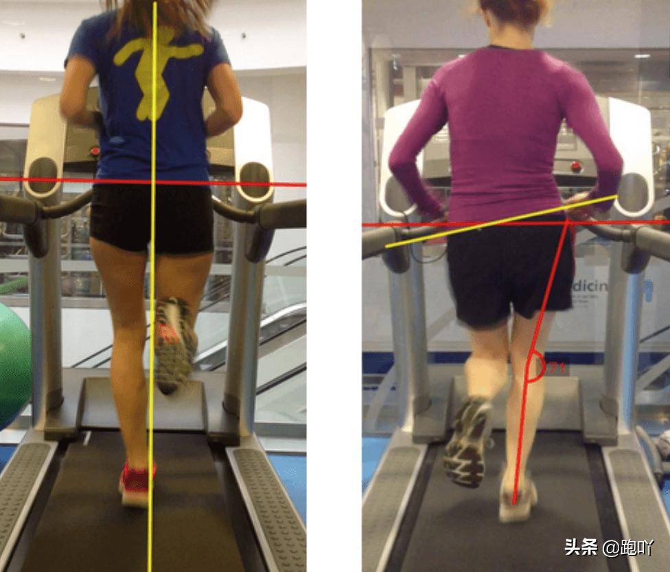 膝盖出问题会小腿麻吗,膝盖出问题脚趾头麻