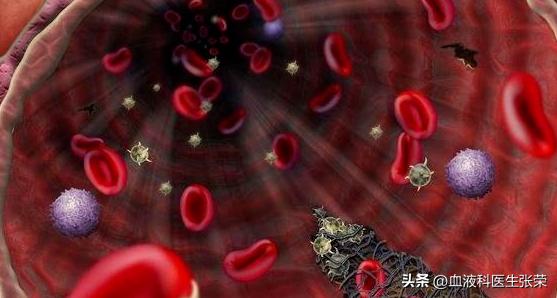 多发性骨髓瘤可以根治吗?日常生活中应该注意什么?带您深入了解