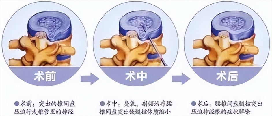 针尖上的艺术,针尖上的艺术效果