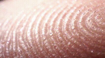 运动神经元显微镜观察内容与结果,显微镜下观察神经元的判断依据