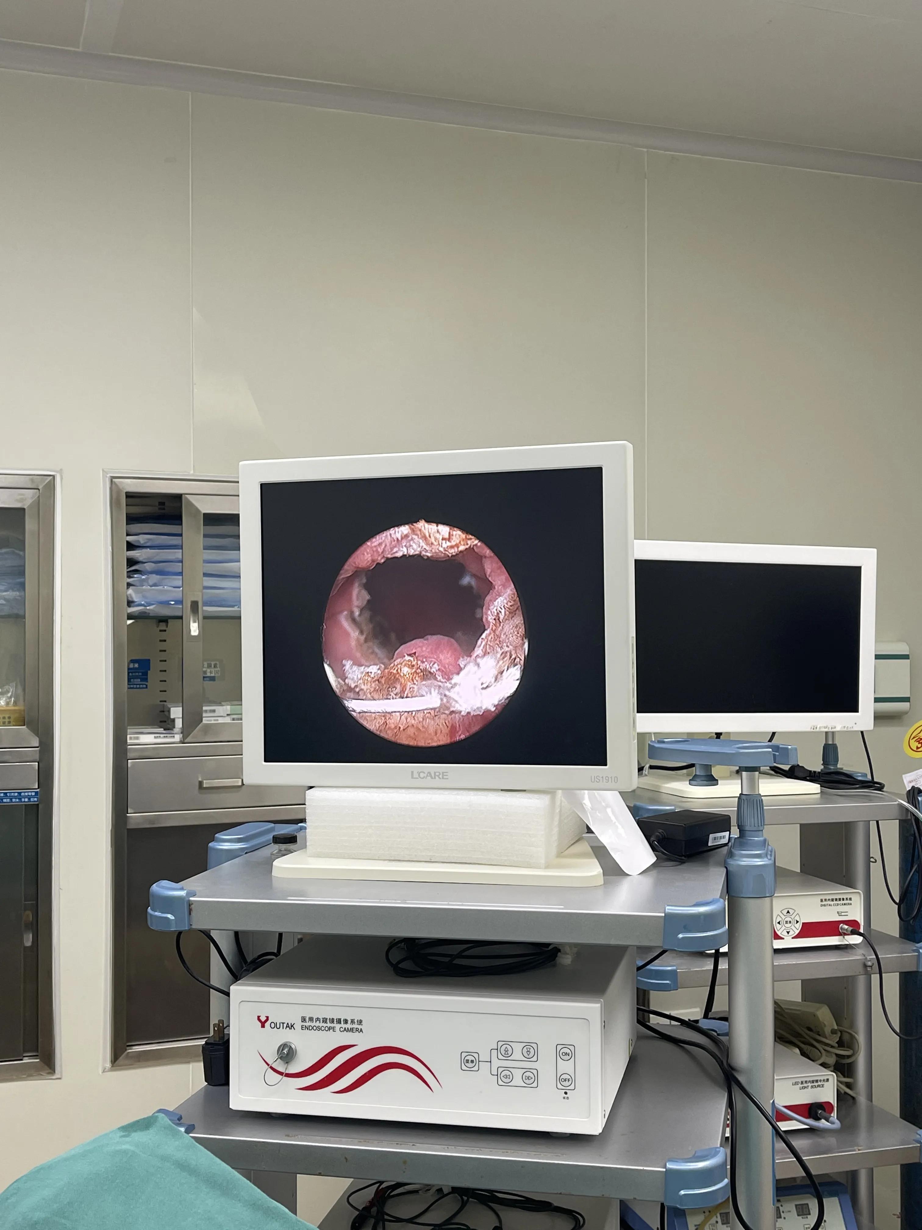 名医札记（113）“套筒穿刺导航法”治愈四川甘孜州膜部尿道闭锁