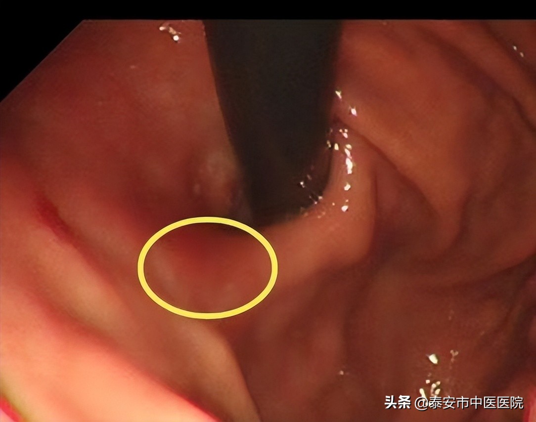 消化内镜微创诊治,消化内镜及消化疾病诊治