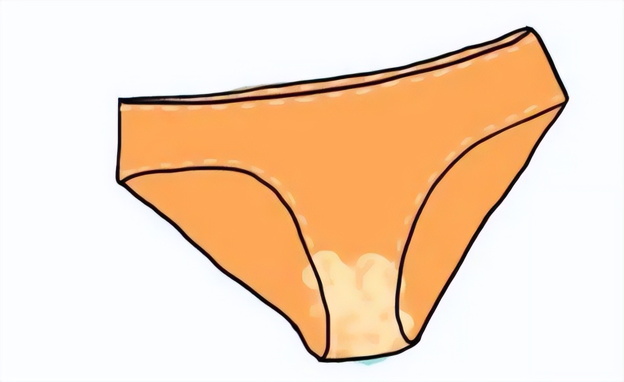 55女子确诊外阴癌，她的坏习惯为所有人敲响警钟，值得借鉴