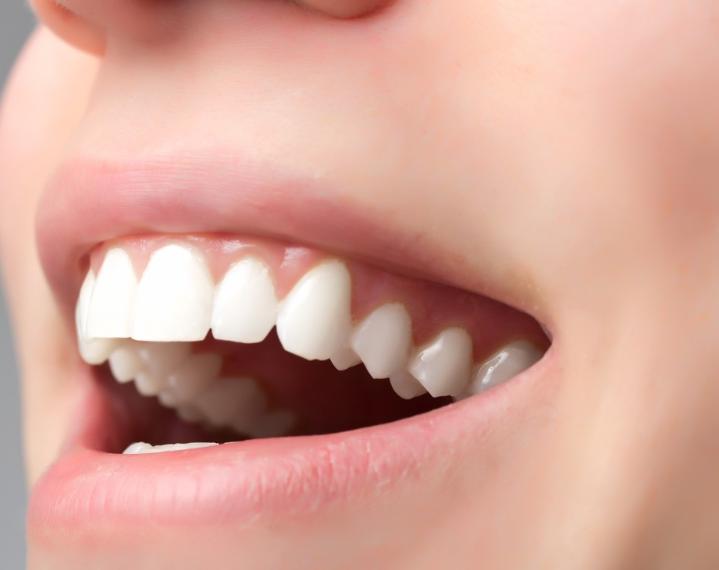 牙根纵裂怎么治疗最好,牙根病变的最好治疗方案