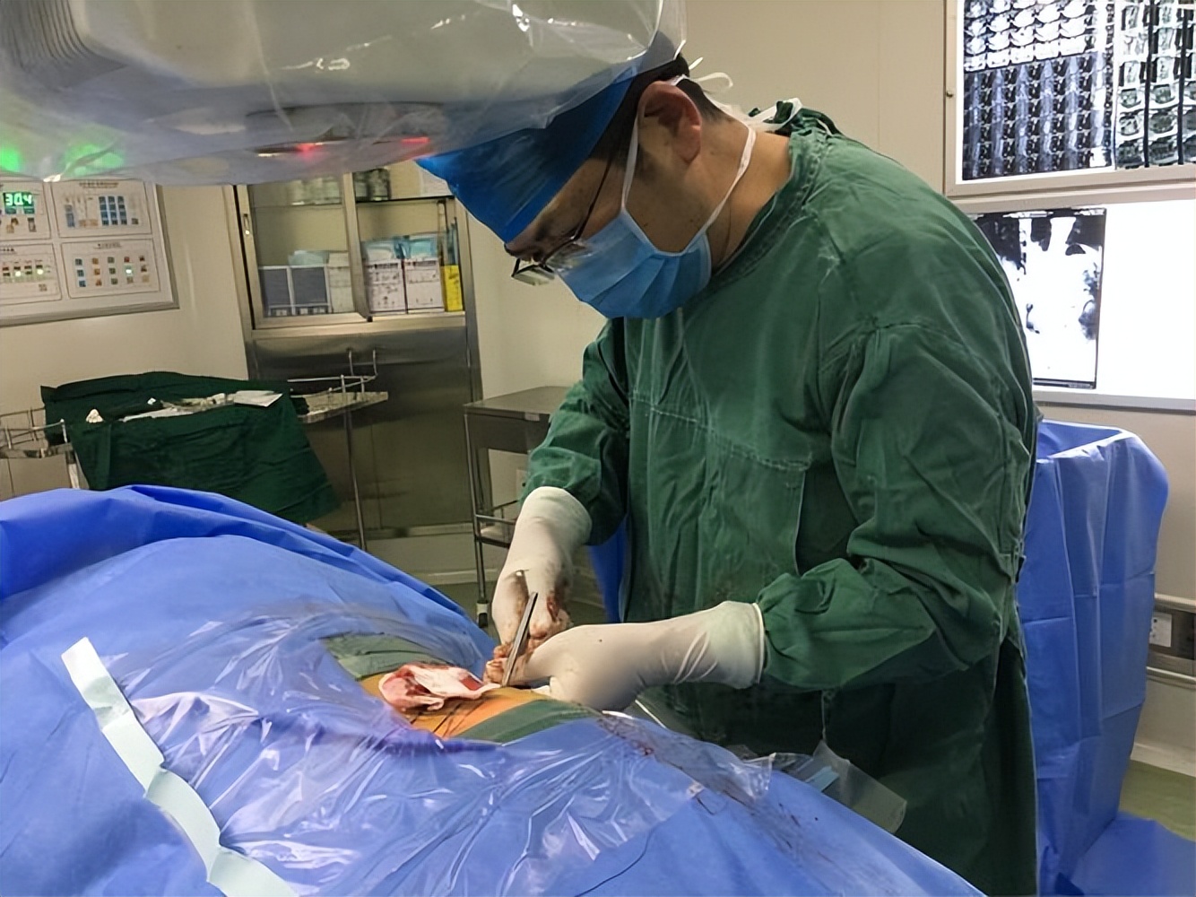 透明质酸钠修复凝胶医用,医用透明质酸钠凝胶防增生吗