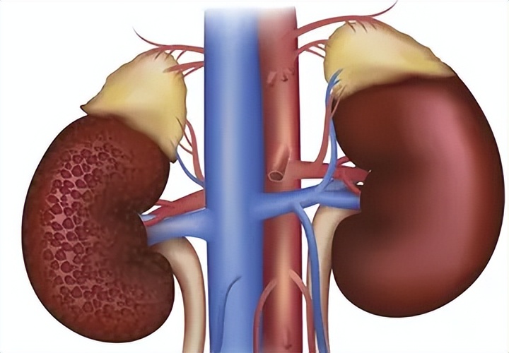 防止心脑血管硬化补充叶酸量,叶酸预防心血管疾病