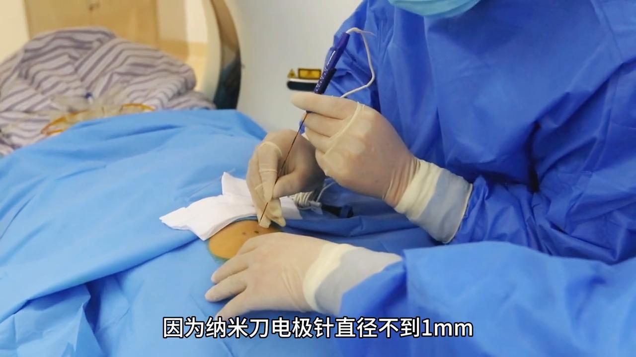 介入和消融治疗肝癌的优点和缺点,纳米消融技术治肝癌在什么医院有