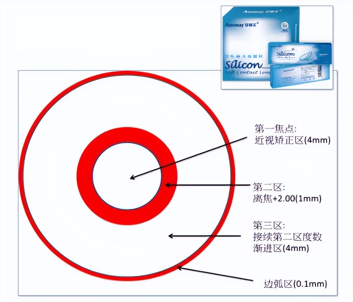 戴ok镜怎么才能提高白天视力,ok镜能临时让眼睛提高视力吗