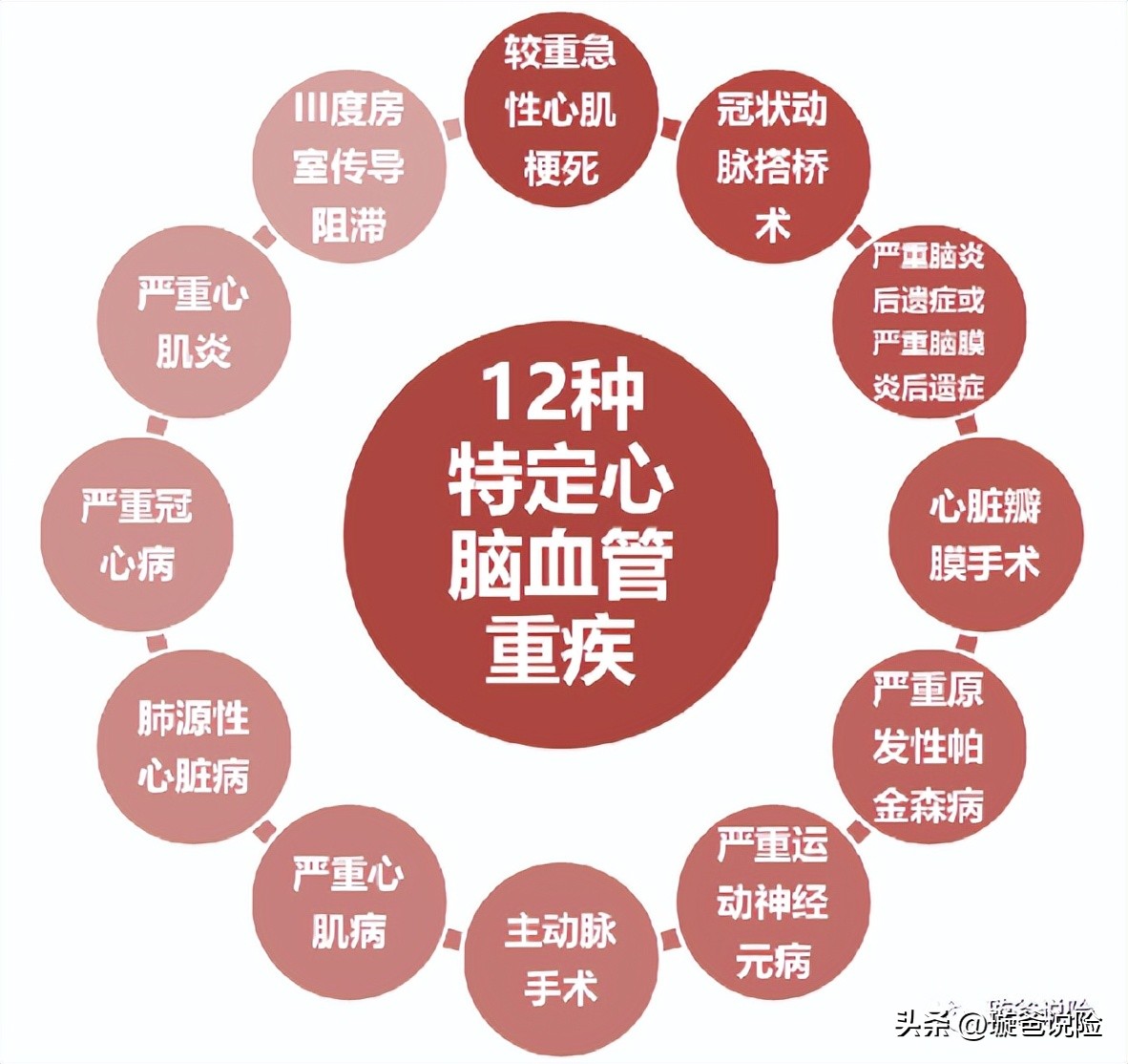 工银安盛御享颐生重疾保险,工银安盛御享人生重疾险怎么样