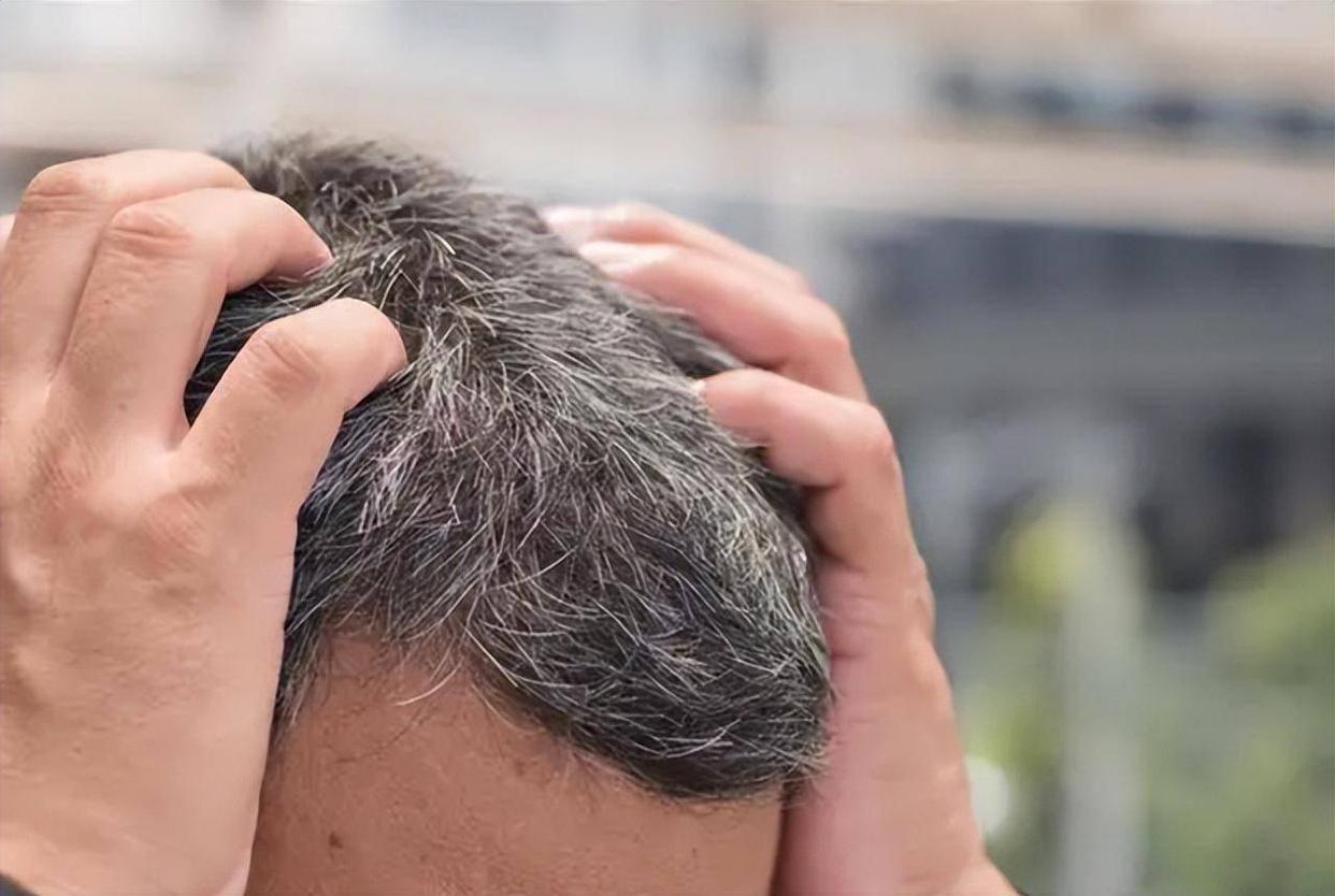 两鬓出现白发是身体哪个部位,两鬓后脑勺都长出白发是什么原因