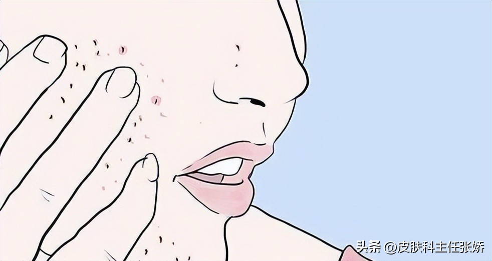 痘痘痘印痘坑看中医可以解决吗,痘痘痘印痘坑怎么治疗效果最好