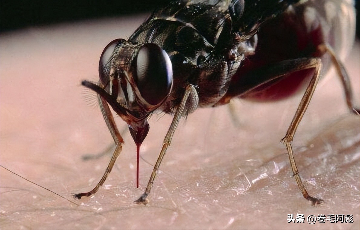 女子被12只蜱虫咬,美国女子被虫子咬