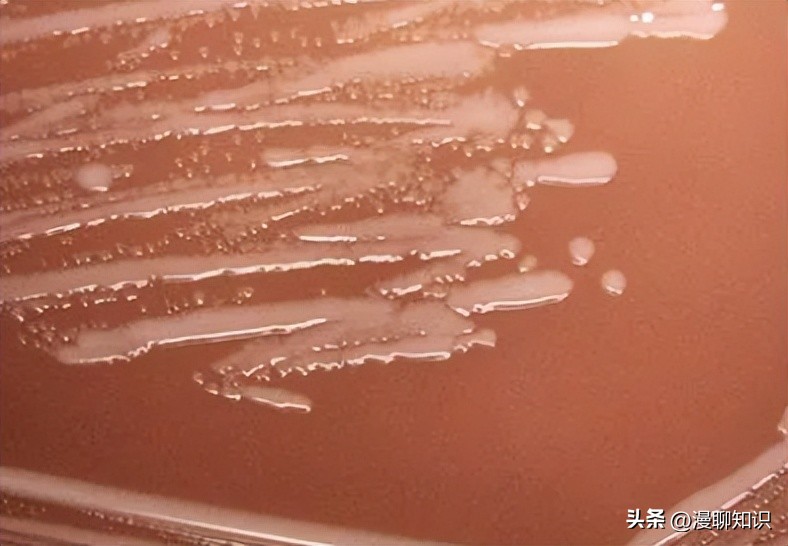 副猪嗜血杆菌是一种巴氏杆菌，其生长依赖于V因子，还有其他的吗