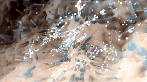 降尿酸医生开了非布司他,尿酸800多吃非布司他管用吗