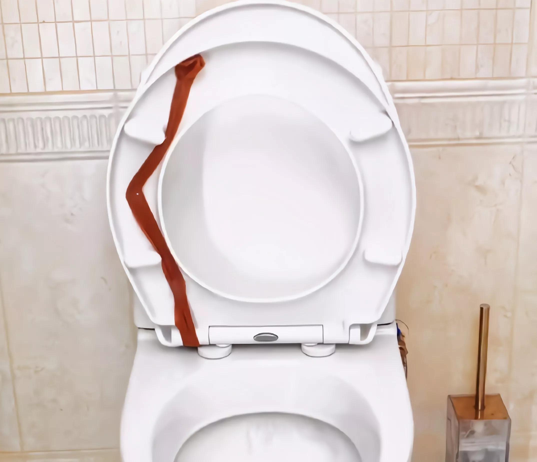 标本切片怎么才能厚薄均匀,日本可调厚薄超薄切片神器