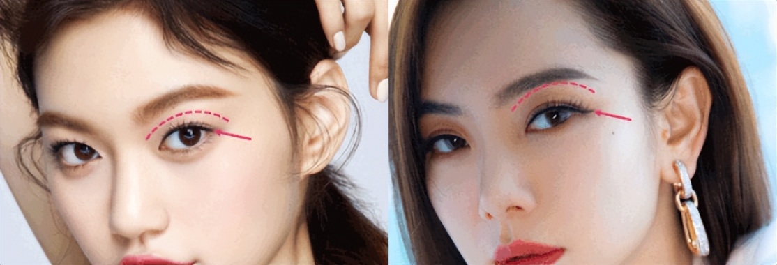 扁平脸影响美感,扁平头会对颜值有影响吗