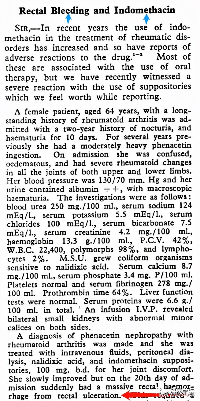 痔疮用吲哚美辛用药不超过几天,吲哚美辛栓剂痔疮术后可以用么