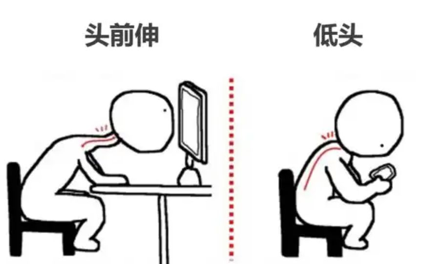 长时间低头脖子酸痛缓解操,长时间低头脖子疼怎么按摩