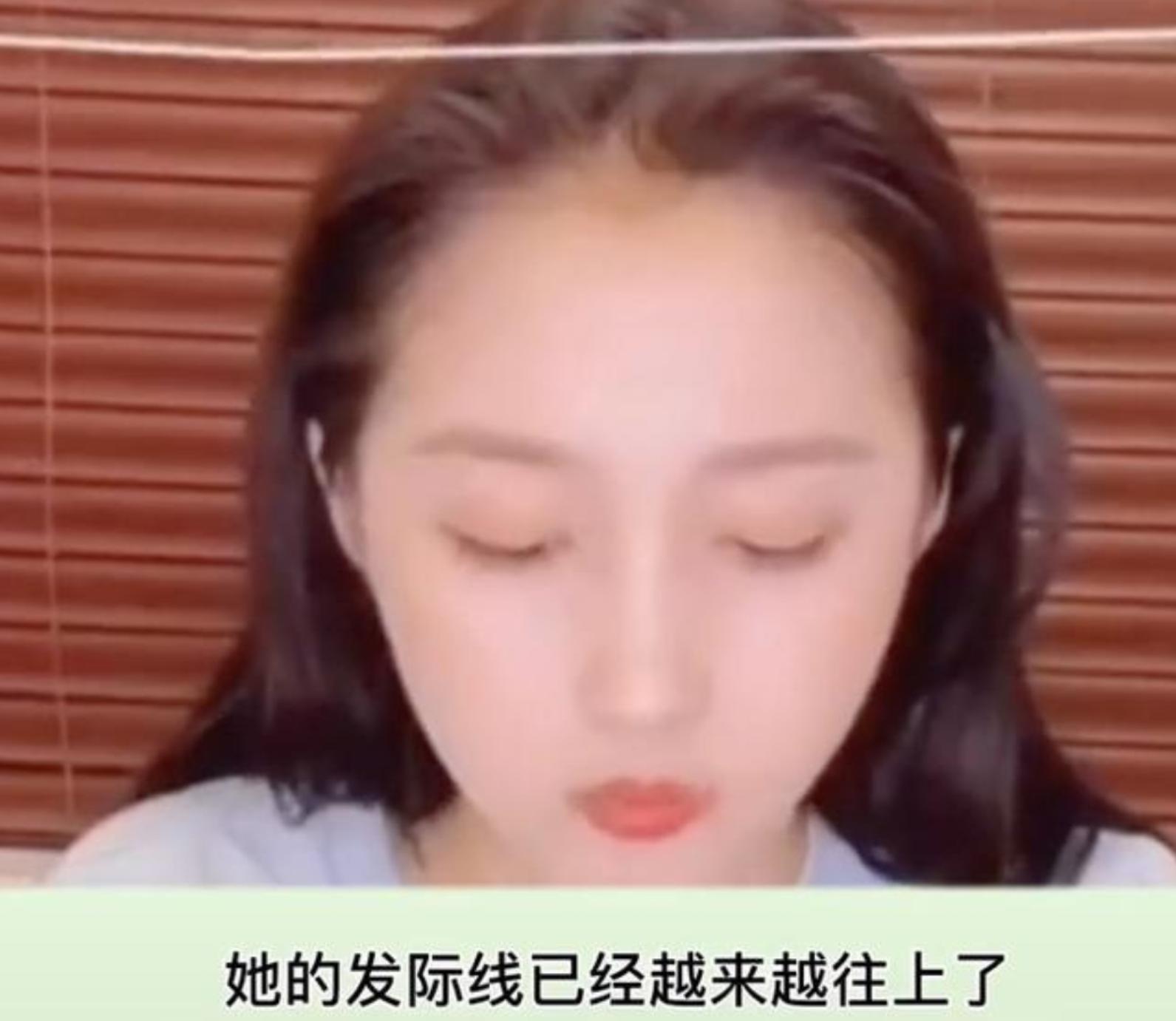 心慌、脱发、牙齿掉光，明星为瘦身花招百出，却被减肥后遗症折磨