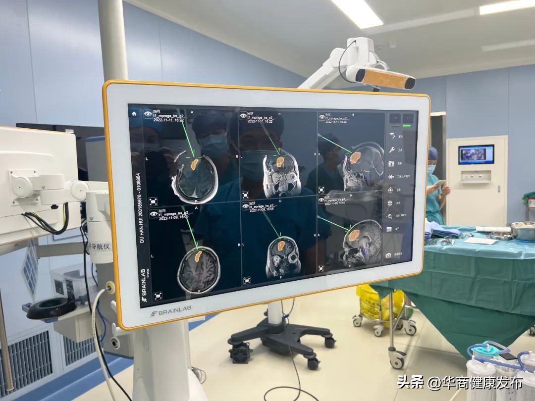 西北首台术中核磁共振登场！术中“核*器武**”精准制导切除多部位颅内肿瘤